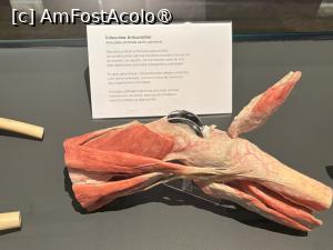 [P09] BODY WORLDS (expozitie de corpuri si organe plastinate) - inlocuirea articulatiilor, exemplificare » foto by mishu
 - 
<span class="allrVoted glyphicon glyphicon-heart hidden" id="av1472929"></span>
<a class="m-l-10 hidden" id="sv1472929" onclick="voting_Foto_DelVot(,1472929,4083)" role="button">șterge vot <span class="glyphicon glyphicon-remove"></span></a>
<a id="v91472929" class=" c-red"  onclick="voting_Foto_SetVot(1472929)" role="button"><span class="glyphicon glyphicon-heart-empty"></span> <b>LIKE</b> = Votează poza</a> <img class="hidden"  id="f1472929W9" src="/imagini/loader.gif" border="0" /><span class="AjErrMes hidden" id="e1472929ErM"></span>